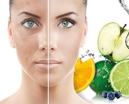 Fruitzuur behandeling (60 min)